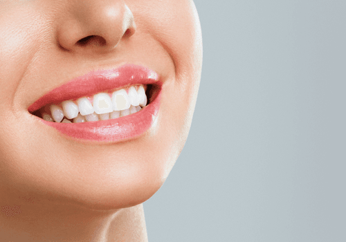 Teeth whitening