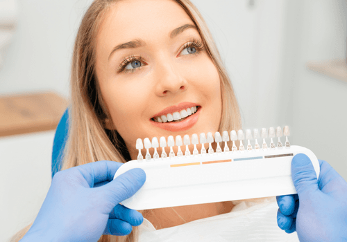 Veneers