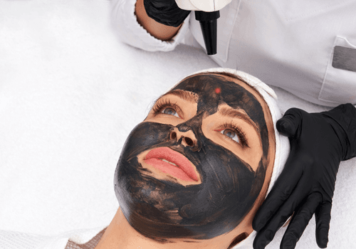 Carbon Facial
